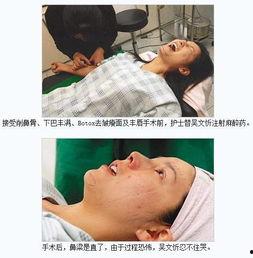 娱乐圈丰胸 贴吧,娱乐圈丰胸秘籍大揭秘！